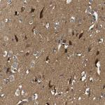 NDRG3 Antibody in Immunohistochemistry (Paraffin) (IHC (P))