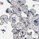NDRG3 Antibody in Immunohistochemistry (Paraffin) (IHC (P))