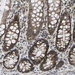 NDRG3 Antibody in Immunohistochemistry (Paraffin) (IHC (P))