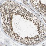 NDRG3 Antibody in Immunohistochemistry (Paraffin) (IHC (P))