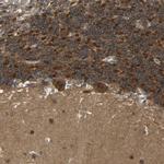 NDRG3 Antibody in Immunohistochemistry (IHC)