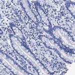 TREML1 Antibody in Immunohistochemistry (IHC)