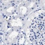 TREML1 Antibody in Immunohistochemistry (IHC)