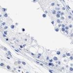 TREML1 Antibody in Immunohistochemistry (IHC)