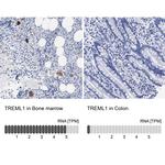 TREML1 Antibody