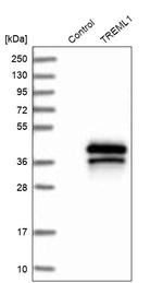 TREML1 Antibody in Western Blot (WB)