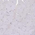 RIOK1 Antibody in Immunohistochemistry (IHC)