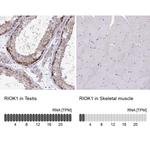 RIOK1 Antibody