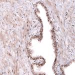 TNRC6A Polyclonal Antibody