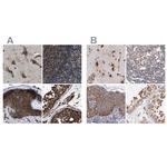 KTN1 Polyclonal Antibody