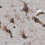 KTN1 Antibody in Immunohistochemistry (IHC)