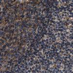 KTN1 Antibody in Immunohistochemistry (IHC)