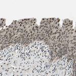 TOX4 Antibody in Immunohistochemistry (IHC)