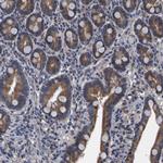 FRRS1 Antibody in Immunohistochemistry (Paraffin) (IHC (P))
