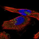 YIPF4 Polyclonal Antibody