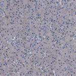 GPR179 Polyclonal Antibody
