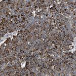 GPR179 Antibody in Immunohistochemistry (Paraffin) (IHC (P))