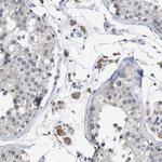 GPR179 Antibody in Immunohistochemistry (Paraffin) (IHC (P))
