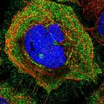 SLC36A4 Polyclonal Antibody