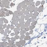 SLC36A4 Antibody in Immunohistochemistry (Paraffin) (IHC (P))