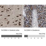 SLC36A4 Antibody in Immunohistochemistry (IHC)