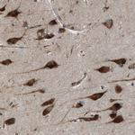 SLC36A4 Antibody in Immunohistochemistry (IHC)