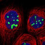 RRP1B Antibody in Immunocytochemistry (ICC/IF)