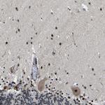 RRP1B Antibody in Immunohistochemistry (Paraffin) (IHC (P))