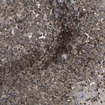 RRP1B Antibody in Immunohistochemistry (Paraffin) (IHC (P))