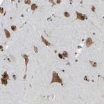 TAIP2 Antibody in Immunohistochemistry (Paraffin) (IHC (P))