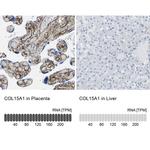 COL15A1 Antibody in Immunohistochemistry (IHC)
