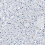 COL15A1 Antibody in Immunohistochemistry (IHC)