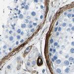 COL15A1 Antibody in Immunohistochemistry (IHC)