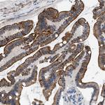 Nudel Polyclonal Antibody