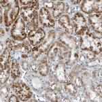 PDCD11 Polyclonal Antibody