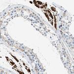 ULK4 Antibody in Immunohistochemistry (Paraffin) (IHC (P))