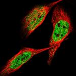 ZNF31 Polyclonal Antibody