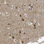 LRRC8B Antibody in Immunohistochemistry (Paraffin) (IHC (P))