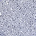 LRRC8B Antibody in Immunohistochemistry (Paraffin) (IHC (P))