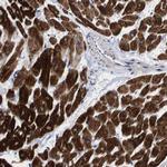 SHD Polyclonal Antibody