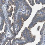 KIAA1462 Antibody in Immunohistochemistry (Paraffin) (IHC (P))