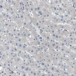 KIAA1462 Antibody in Immunohistochemistry (Paraffin) (IHC (P))