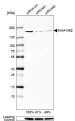 KIAA1462 Antibody