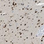 KIAA1462 Antibody in Immunohistochemistry (IHC)