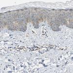 KIAA1462 Antibody in Immunohistochemistry (IHC)