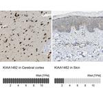 KIAA1462 Antibody
