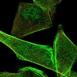 PALMD Polyclonal Antibody