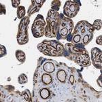 PALMD Antibody in Immunohistochemistry (IHC)