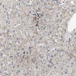 PALMD Antibody in Immunohistochemistry (IHC)