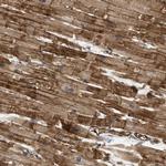 PALMD Antibody in Immunohistochemistry (IHC)